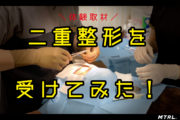 【タイガモンスター】二重整形手術を受けてきた！